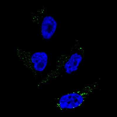 Immunocytochemistry/ Immunofluorescence: TYRP1 Antibody (CL4923) [NBP2-61642]