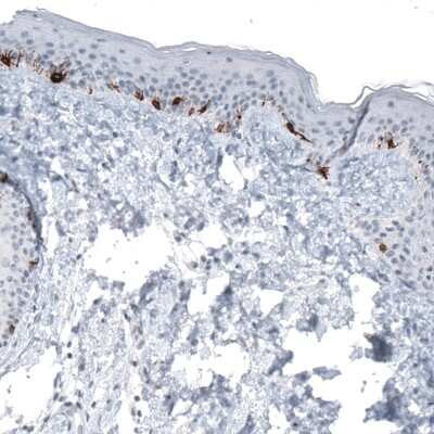 Immunohistochemistry-Paraffin: TYRP1 Antibody (CL4923) [NBP2-61642]