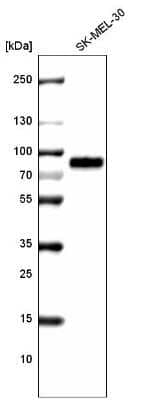 Western Blot: TYRP1 Antibody (CL4923) [NBP2-61642]