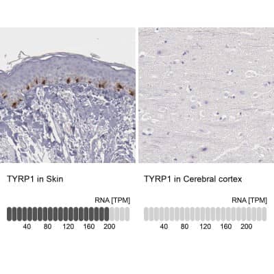 Immunohistochemistry-Paraffin: TYRP1 Antibody [NBP1-88370]