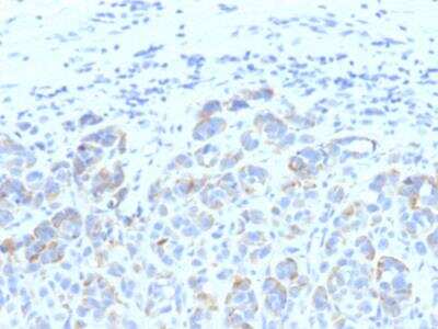 Immunohistochemistry-Paraffin: TYRP1 Antibody (SPM611) - IHC-Prediluted [NBP2-48129]