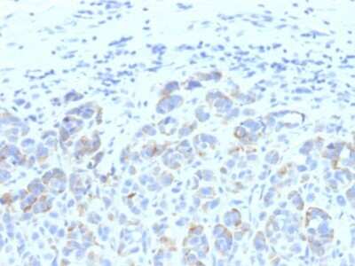 Immunohistochemistry-Paraffin: TYRP1 Antibody (SPM611) [NBP2-44620]