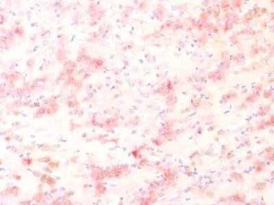 Immunohistochemistry-Paraffin: TYRP1 Antibody (TYRP1/1564R) [NBP2-53252]