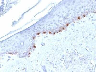 Immunohistochemistry-Paraffin: TYRP1 Antibody (TYRP1/1986) - Azide and BSA Free [NBP2-61600]