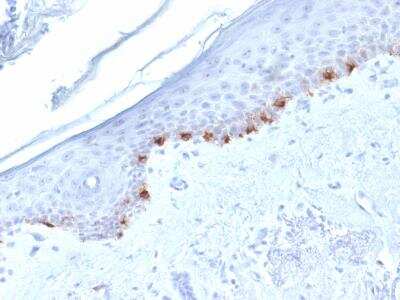 Immunohistochemistry-Paraffin: TYRP1 Antibody (TYRP1/1986) [NBP2-61599]