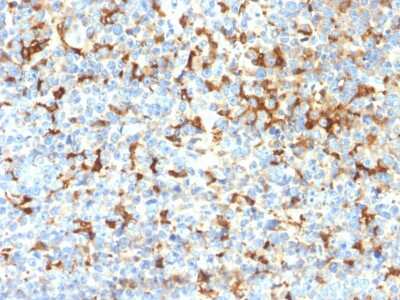 Immunohistochemistry-Paraffin: TYRP1 Antibody (TYRP1/2340R) - Azide and BSA Free [NBP3-08898]