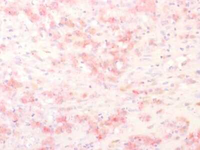 Immunohistochemistry-Paraffin: TYRP1 Antibody (TYRP1/2340R) - Azide and BSA Free [NBP3-08898]