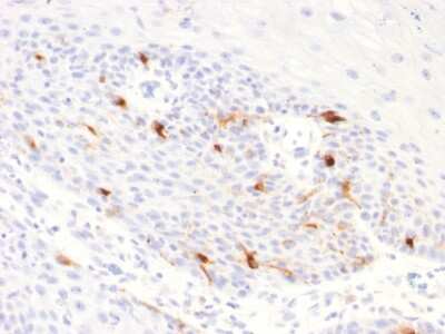 Immunohistochemistry-Paraffin: TYRP1 Antibody (TYRP1/2340R) - Azide and BSA Free [NBP3-08898]