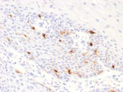 Immunohistochemistry-Paraffin: TYRP1 Antibody (TYRP1/2340R) [NBP3-07156]