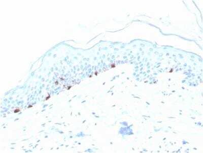 Immunohistochemistry-Paraffin: TYRP1 Antibody (TYRP1/3280) - Azide and BSA Free [NBP2-79926]