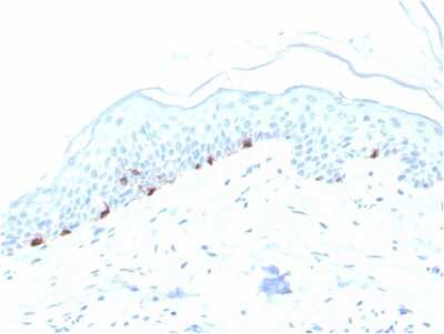 Immunohistochemistry-Paraffin: TYRP1 Antibody (TYRP1/3280) [NBP2-79792]