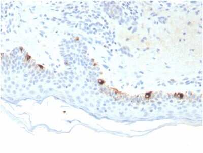 Immunohistochemistry-Paraffin: TYRP1 Antibody (TYRP1/3281) [NBP3-07155]