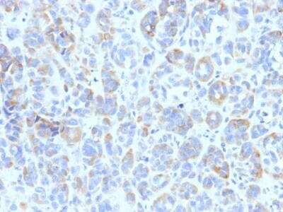 Immunohistochemistry-Paraffin: TYRP1 Antibody (TYRP1/807) - IHC-Prediluted [NBP2-48128]