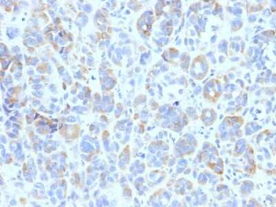 Immunohistochemistry-Paraffin: TYRP1 Antibody (TYRP1/807) [NBP2-44621]