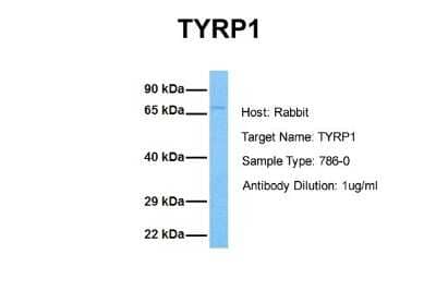 Western Blot: TYRP1 Antibody [NBP1-69542]