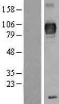 Western Blot: TYRP1 Overexpression Lysate [NBP2-04163]