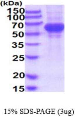 SDS-PAGE: Recombinant Human TYRP1 His Protein [NBP2-52623]