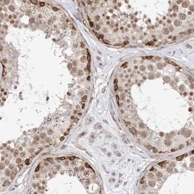 Immunohistochemistry-Paraffin: TYSND1 Antibody [NBP1-93484]
