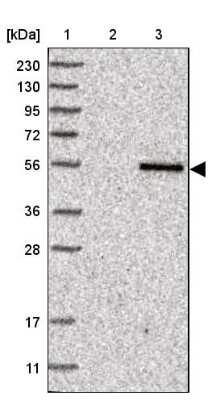 Western Blot: TYSND1 Antibody [NBP1-93484]