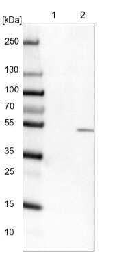 Western Blot: TYSND1 Antibody [NBP1-93484]