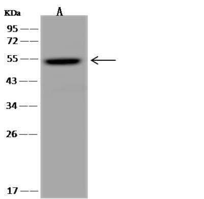 Western Blot: TYSND1 Antibody [NBP3-05923]