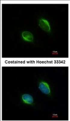 Immunocytochemistry/ Immunofluorescence: TYW1 Antibody [NBP2-20772]