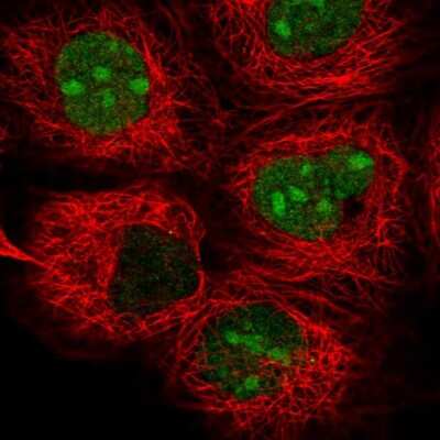 Immunocytochemistry/ Immunofluorescence: TYW1 Antibody [NBP2-58222]