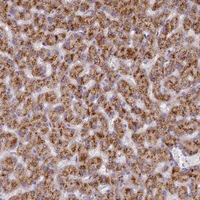 Immunohistochemistry: TYW1B Antibody [NBP2-38128]