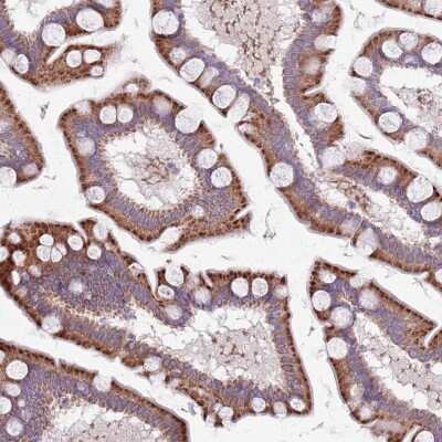 Immunohistochemistry: TYW1 Antibody [NBP2-38562]