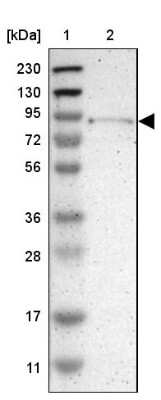 Western Blot: TYW1 Antibody [NBP1-83814]