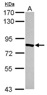 Western Blot: TYW1 Antibody [NBP2-20772]