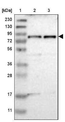 Western Blot: TYW1B Antibody [NBP2-38128]