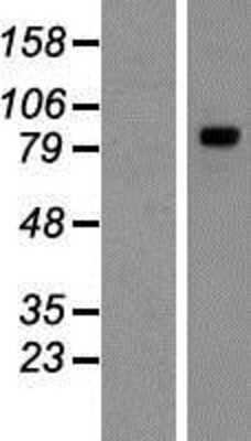 Western Blot: TYW1 Overexpression Lysate [NBP2-06831]