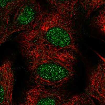 Immunocytochemistry/ Immunofluorescence: TYW1B Antibody [NBP2-58293]