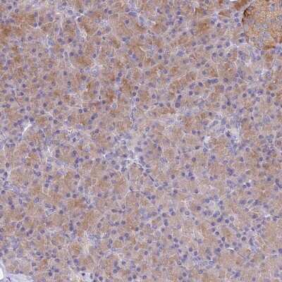 Immunohistochemistry: TYW1B Antibody [NBP2-38563]