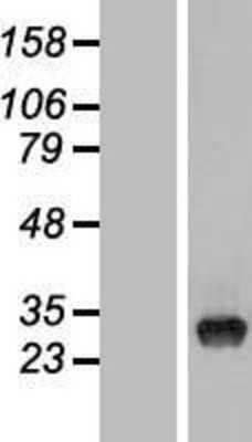 Western Blot: TYW3 Overexpression Lysate [NBL1-17487]