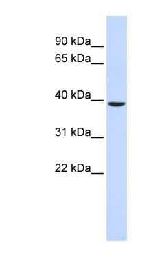 Western Blot: TYW5 Antibody [NBP1-91416]