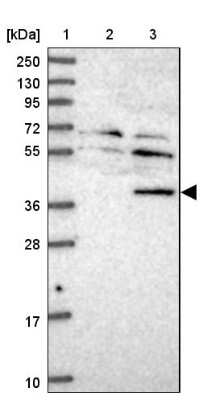 Western Blot: TYW5 Antibody [NBP1-94109]