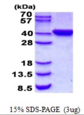 SDS-PAGE: Recombinant Human TYW5 His Protein [NBP2-22891]