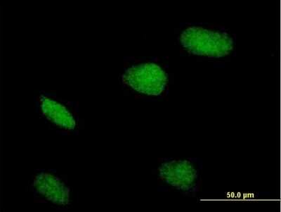 Immunocytochemistry/ Immunofluorescence: TZFP Antibody [H00027033-B01P]