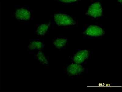 Immunocytochemistry/ Immunofluorescence: TZFP Antibody [H00027033-B02P]