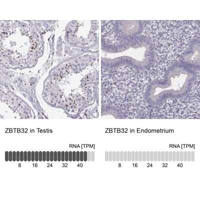 Immunohistochemistry-Paraffin: TZFP Antibody [NBP2-62707]