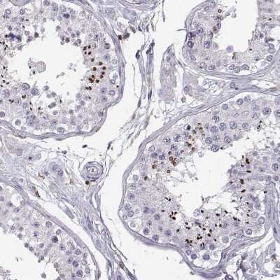 Immunohistochemistry-Paraffin: TZFP Antibody [NBP2-62707]
