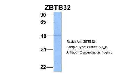 Western Blot: TZFP Antibody [NBP1-79984]