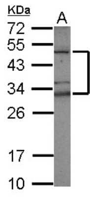 Western Blot: TZFP Antibody [NBP2-20773]