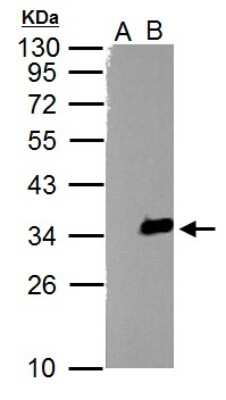 Western Blot: TZFP Antibody [NBP2-20773]