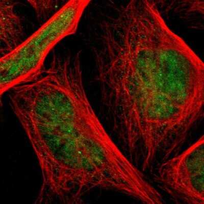 Immunocytochemistry/ Immunofluorescence: Taf4 Antibody [NBP1-80705]