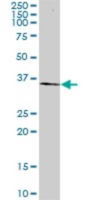 Western Blot: Tafazzin/TAZ Antibody (1B10) [H00006901-M12]