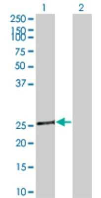 Western Blot: Tafazzin/TAZ Antibody (1F9) [H00006901-M15]