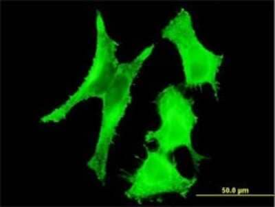 Immunocytochemistry/ Immunofluorescence: Tafazzin/TAZ Antibody (3C10) [H00006901-M19]